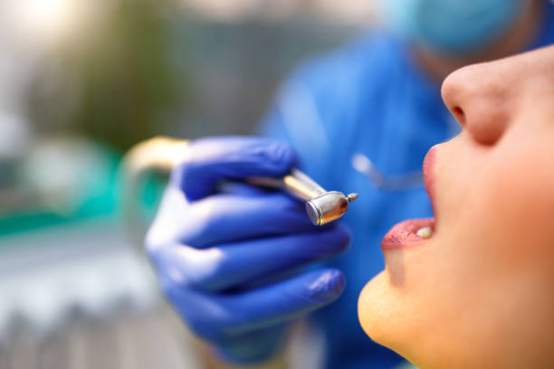 Oral Cancer Screening in Solana Beach, CA